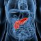 LA MUERTE POR CÁNCER DE PÁNCREAS SUBIRÁ EN EL RANKING AL AÑO 2030
