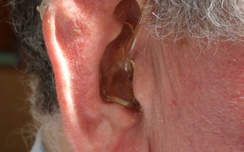 Investigadores de fonoaudiología UC y hospital La Florida confirman que el ingreso económico influye en el abandono en  el uso de audífonos